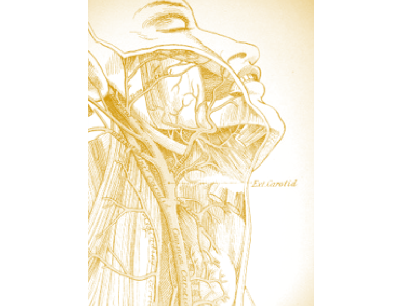 Carotid endarterectomy surgery