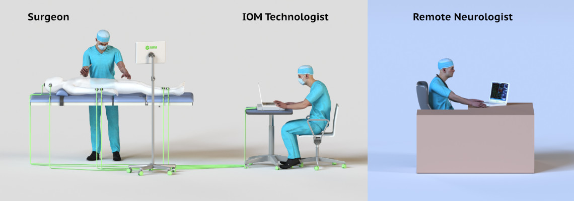 intraoperative neuromonitoring