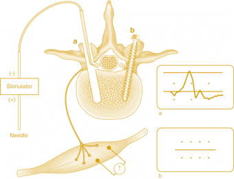 thoracic surgery